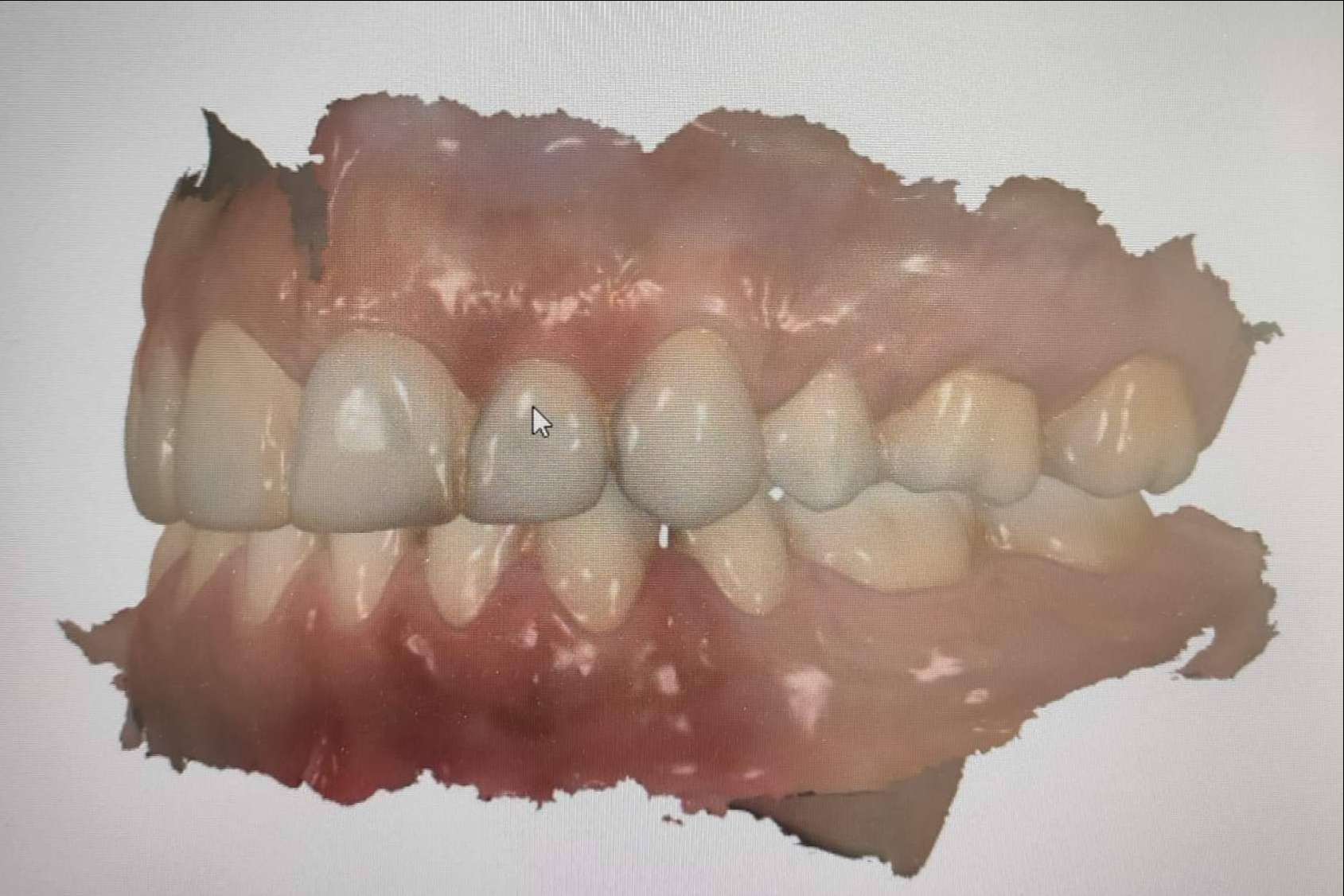 El escáner de última tecnología 3Shape TRIOS, disponible en la clínica dental Implant Clinics