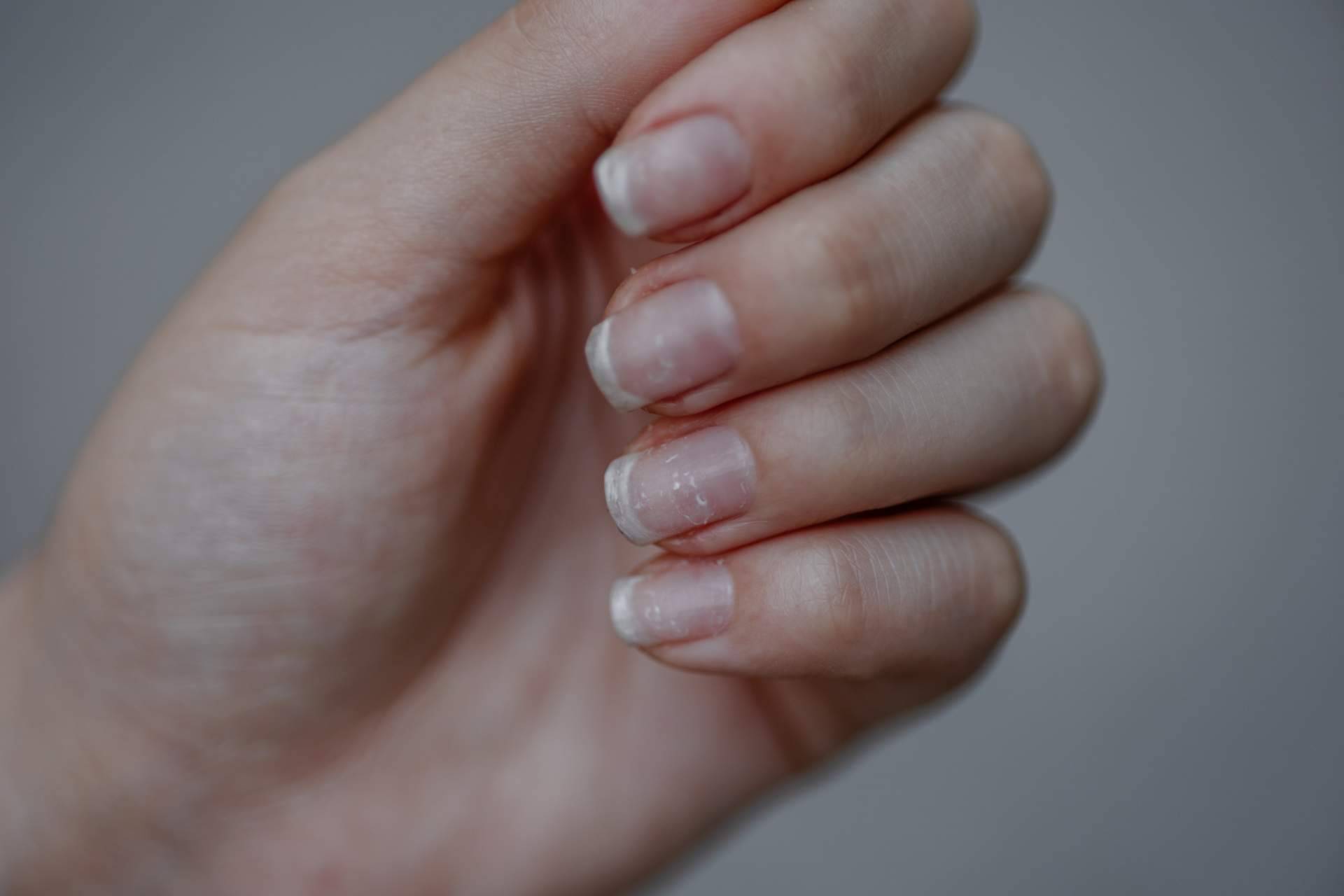 Lazonail®, un tratamiento holístico de uñas y cutículas