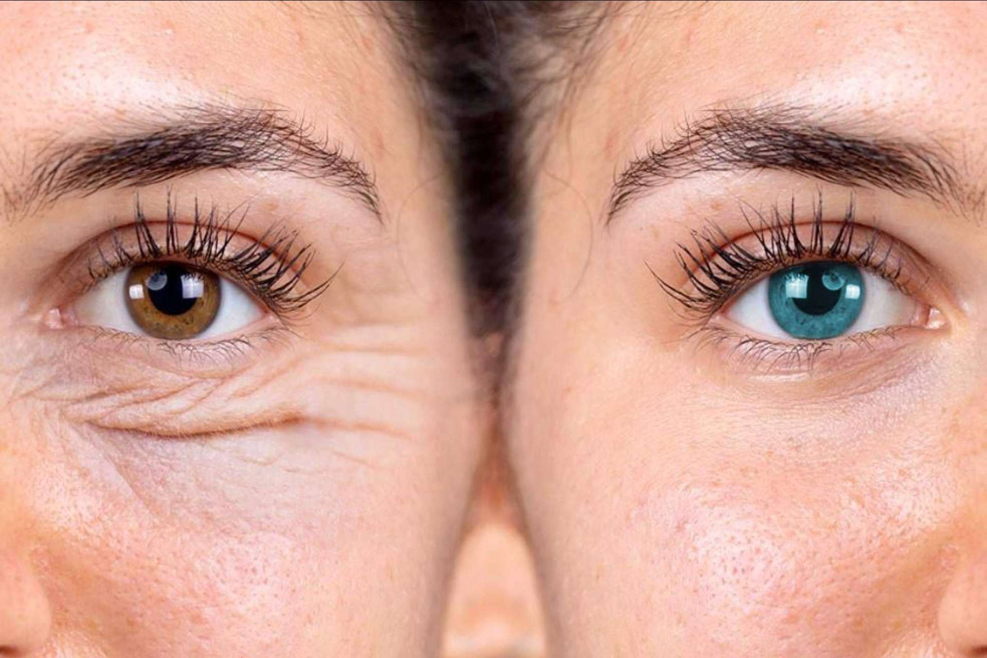 Transformación facial completa con Eyecos
