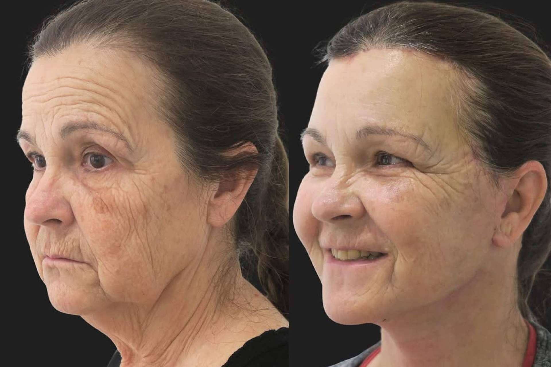 El secreto para un rostro joven; El método de la Dra. Silvia Rosón que arrasa en Madrid