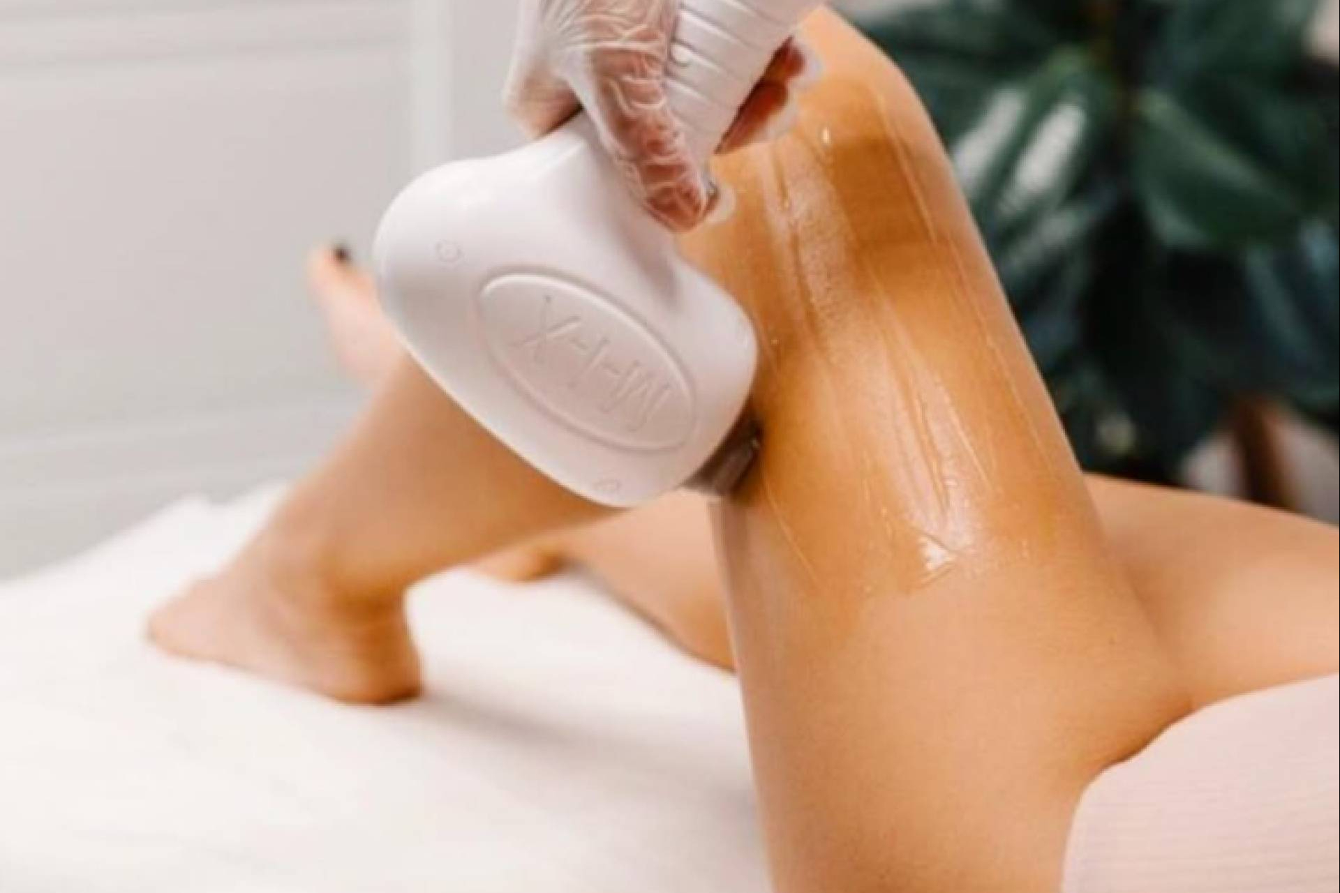 Tecnología corporal y depilación láser; The Clinic presenta sus promociones estrella del mes